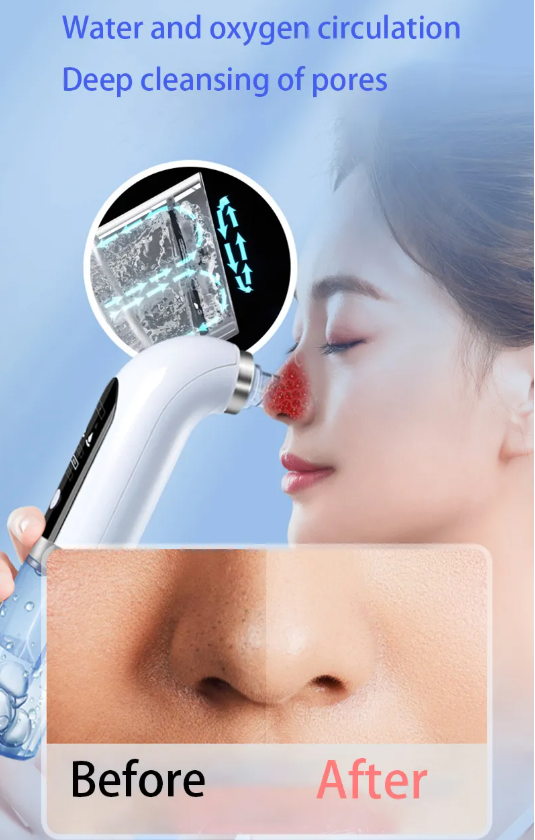 WelthVibe Pore Vacuum — Rechargeable Blackhead Cleaner