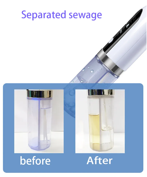 WelthVibe Pore Vacuum — Rechargeable Blackhead Cleaner